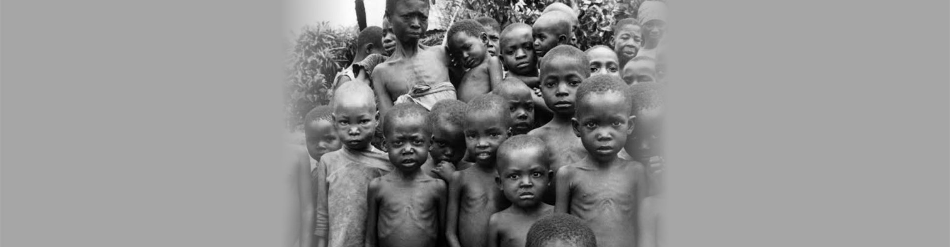 malnourished african children